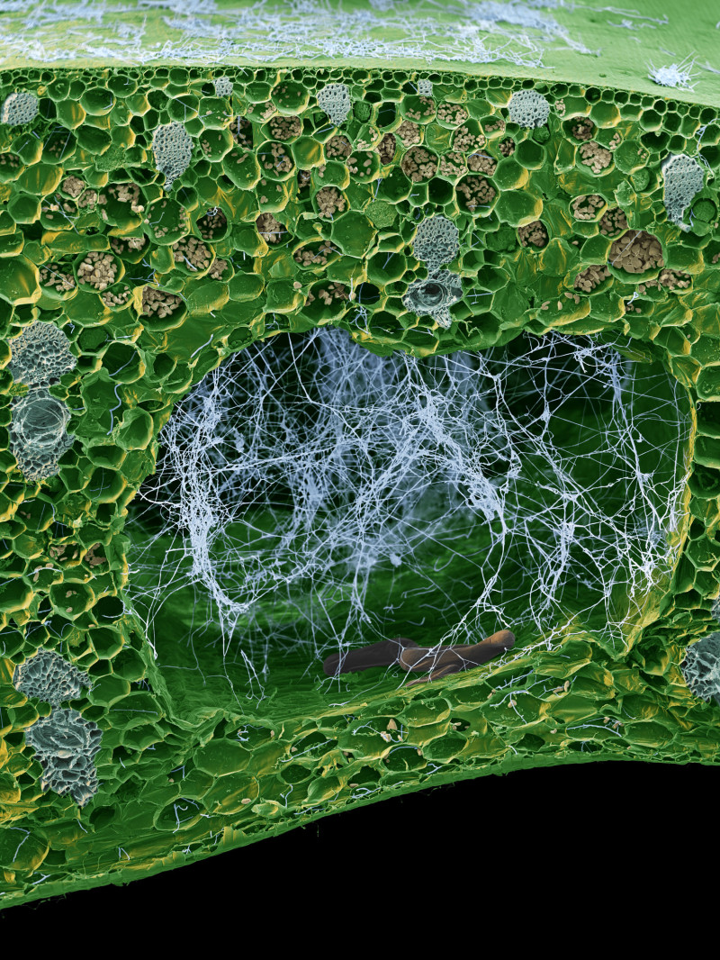 صورة مجهرية إلكترونية لفطر المغزلاوية حادة الأبواغ (Fusarium Odoratissimum) 
