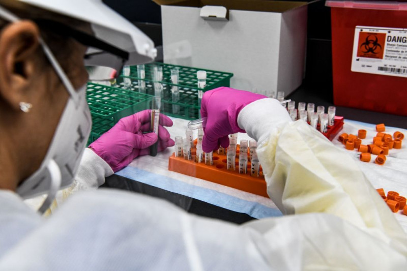 أحد المختصين يفرز عينات الدم داخل مختبر لإجراء دراسة بشأن لقاح كوفيد-19